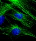 beta Tubulin